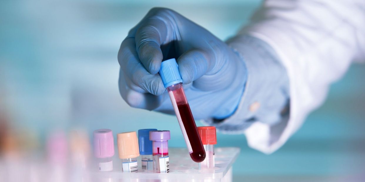 They create proof that detects tumors in early stages