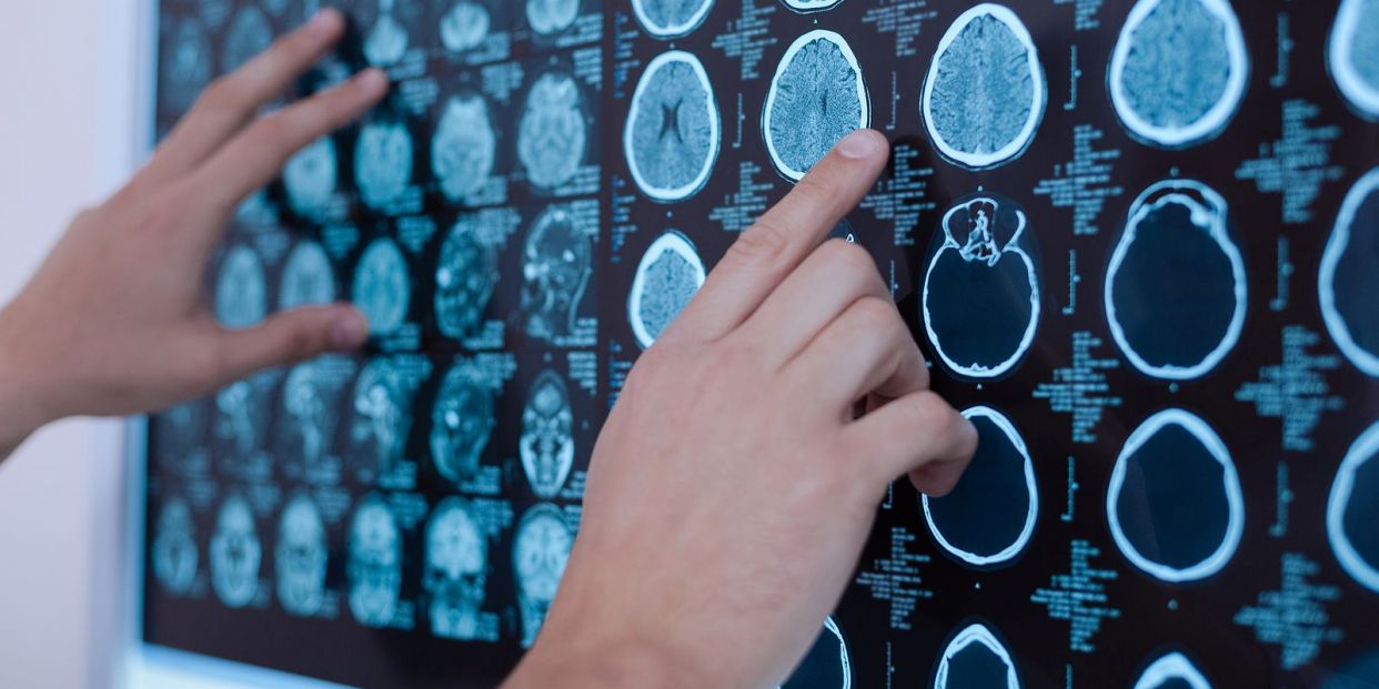drugs that eliminate plaques are not effective