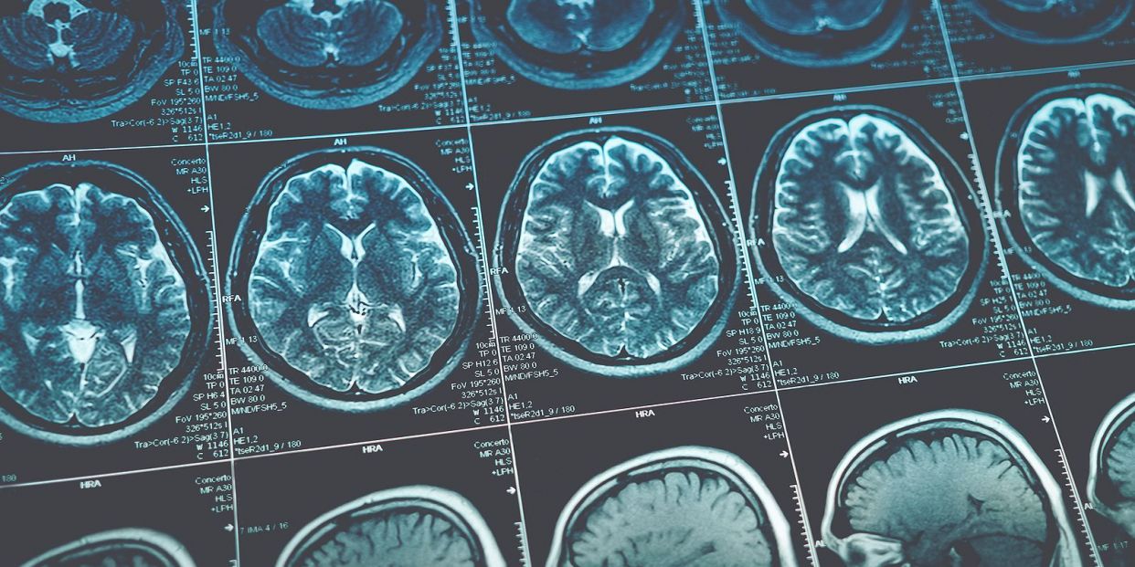 Basque quantum computer, key in the fight against Alzheimer’s