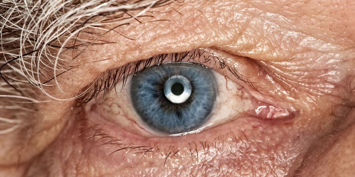 Visual alterations in Parkinson’s disease